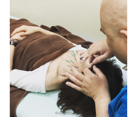 気になっていた、ほうれい線が 中央区MM様